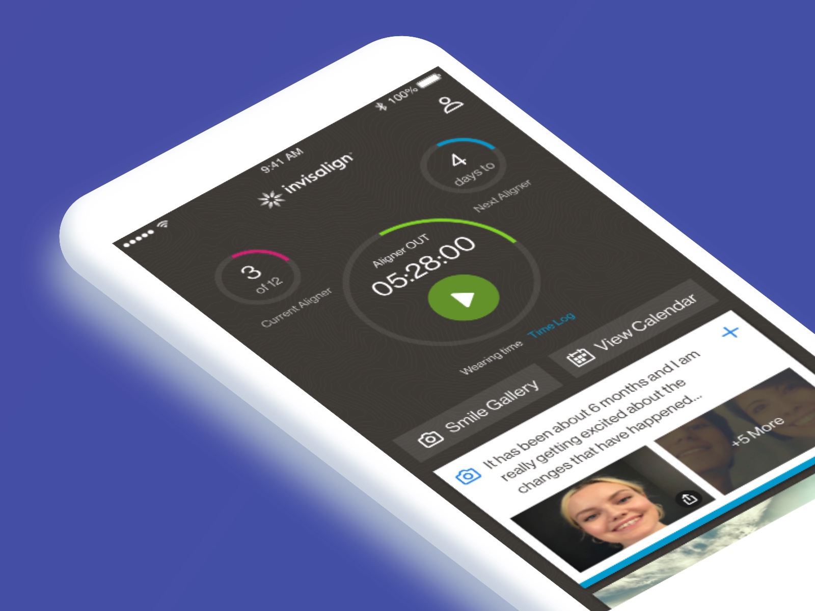 The My Invisalign App on a phone: a large aligner countdown reading 05:28:00, ringed by “3 of 12 current aligner” and “4 days to next aligner”, with the smile gallery below.